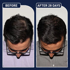 FEG Hair Growth Spray – Natural Hair Thickening & Scalp Repair | Emirazaar UAE