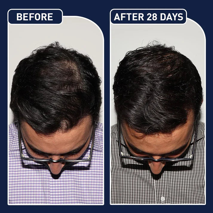 FEG Hair Growth Spray – Natural Hair Thickening & Scalp Repair | Emirazaar UAE
