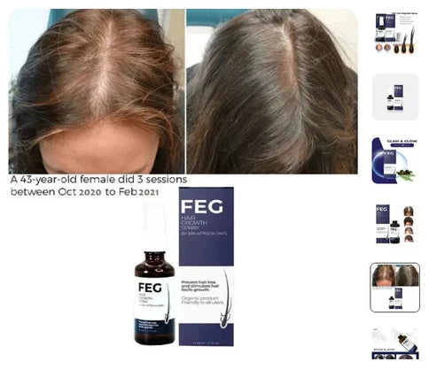 FEG Hair Growth Spray – Natural Hair Thickening & Scalp Repair | Emirazaar UAE