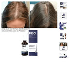 FEG Hair Growth Spray – Natural Hair Thickening & Scalp Repair | Emirazaar UAE