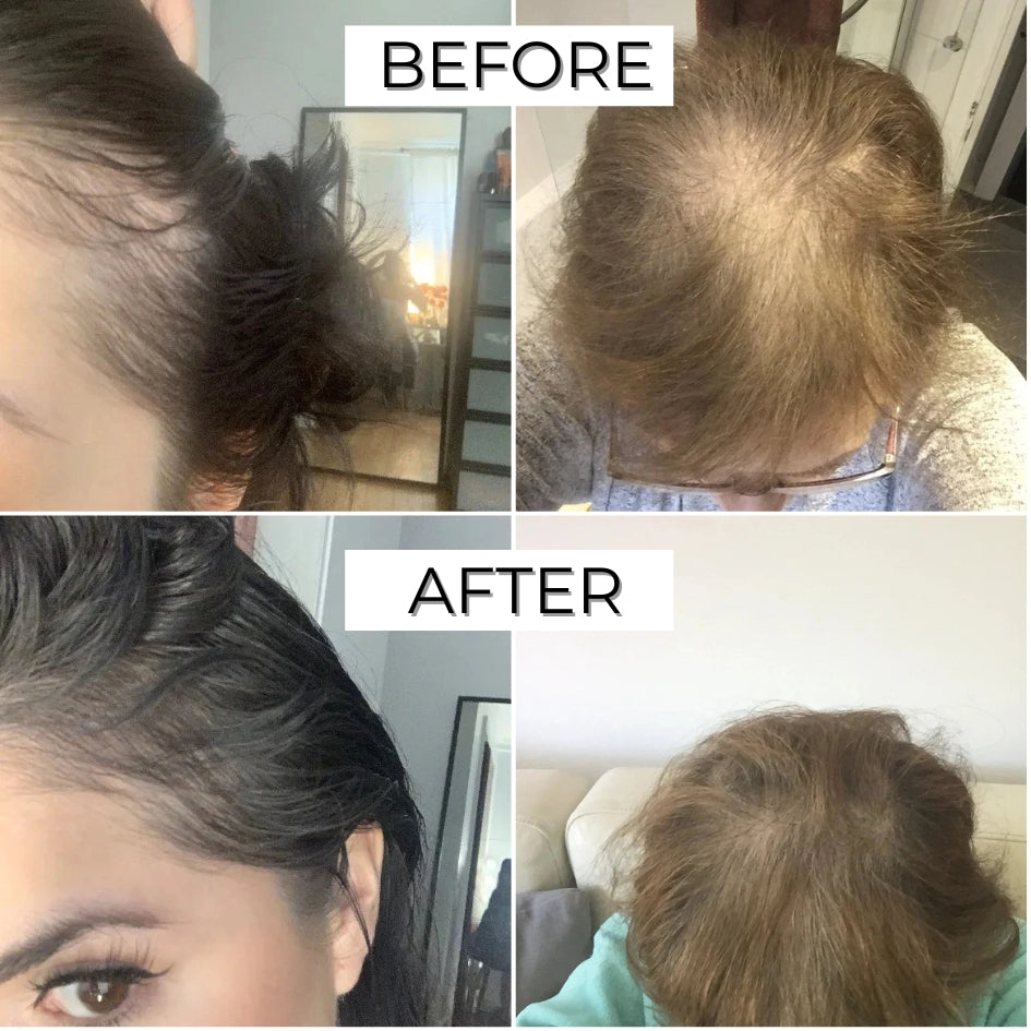FEG Hair Growth Spray – Natural Hair Thickening & Scalp Repair | Emirazaar UAE