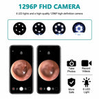 Ear inspection device with 1296P FHD camera and 6 LED lights on a white background.