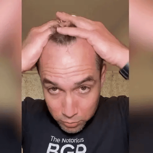 FEG Hair Growth Spray – Natural Hair Thickening & Scalp Repair | Emirazaar UAE